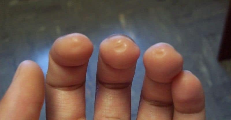 How to Build Guitar Calluses - 5 Quick & Effective Steps